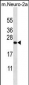 ZCRB1 Antibody (C-term)